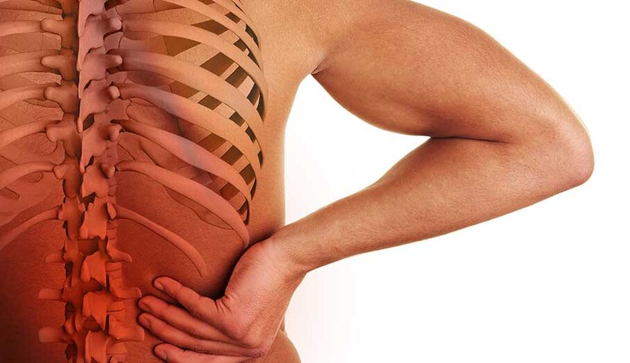 Osteochondrose der Lendenwirbelsäule